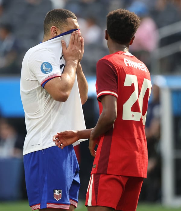 卡梅伦·卡特-维克斯(左)可能最多缺阵五个月。/ Luiza Moraes/USSF/Getty Images for USSF