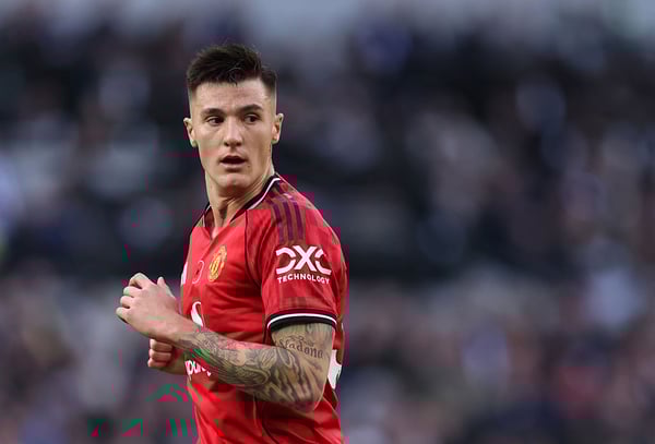 世界杯FIFA体育新闻：尚未着火。/ Catherine Ivill/AMA/Getty Images